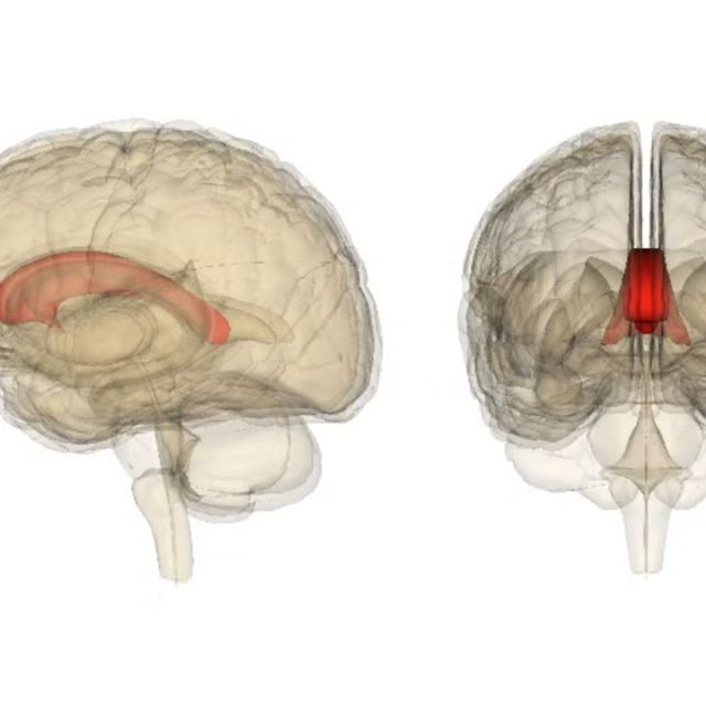 The corpus callosum, in red, connects the two hemispheres of the brain together.