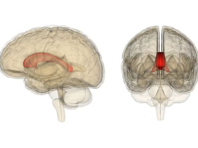 The corpus callosum, in red, connects the two hemispheres of the brain together.